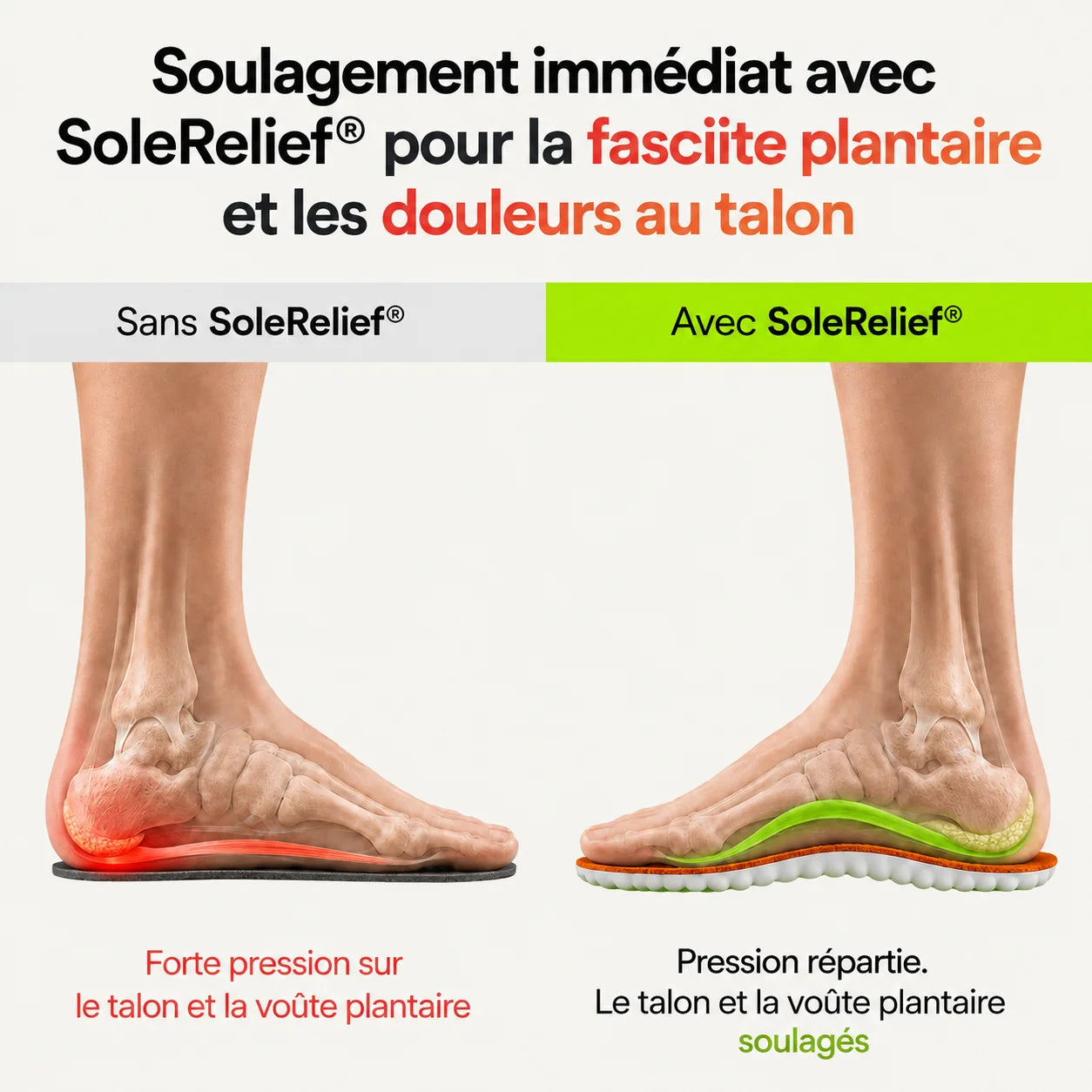 SoleRelief - Semelles de décharge contre les douleurs au talon et la fasciite plantaire