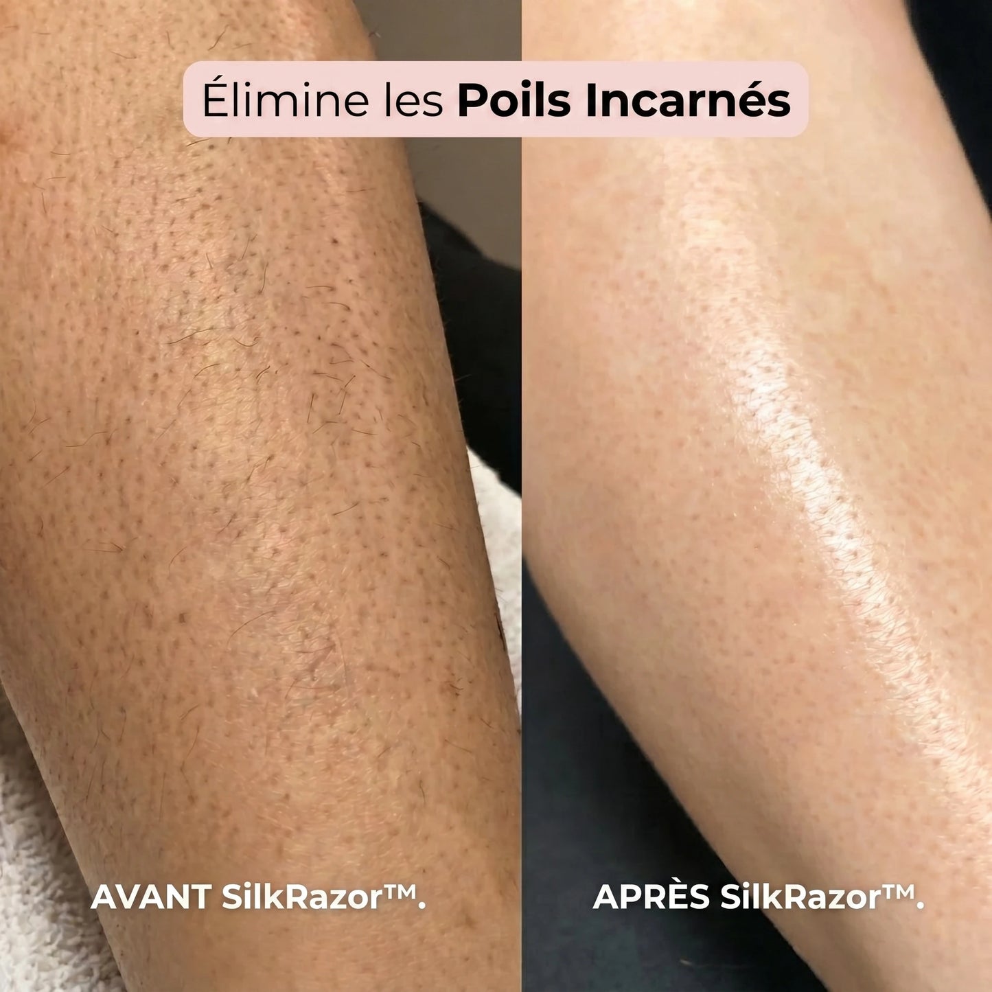 Rasoir 2 en 1 Bikini & Corps | SilkRazor™