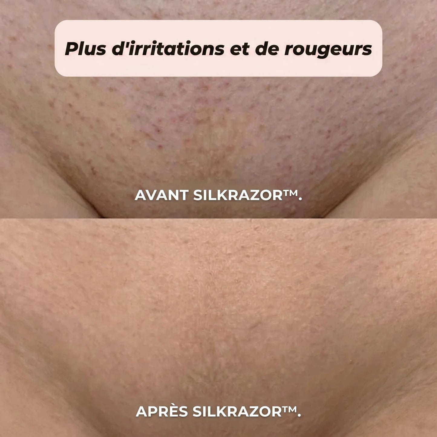 Rasoir 2 en 1 Bikini & Corps | SilkRazor™